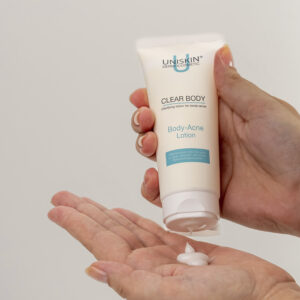 Body-Acne Lotion fra Uniskin – holdt i hånd.