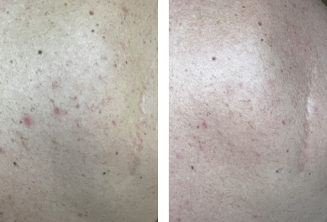 foer_efter_472x320px_5dage_clear body