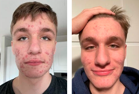 foer_efter_472x320px_marcus 16