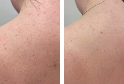 foer_efter_472x320px_marlene 29